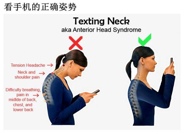 转贴 | 欧洲脊柱协会声明：“短信脖”是新一代人全球性疾病！