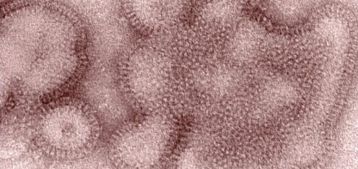 两波流感病毒创造了美国十年来最长的流感季