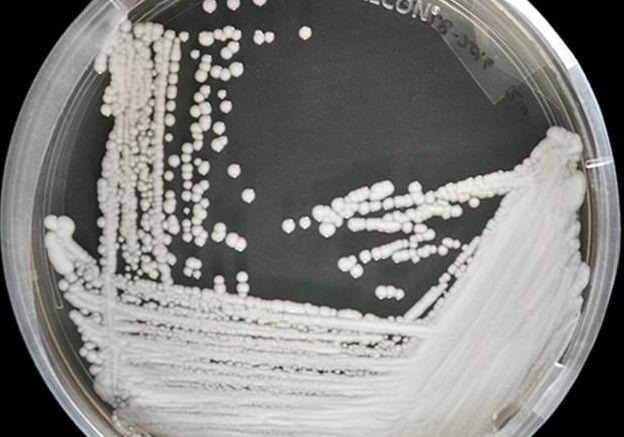 美国多地爆发超级真菌,近50%感染者90天内死亡