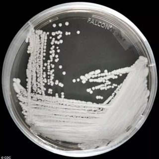 可怕！美國多地爆發超級真菌，近50%感染者90天內死亡…