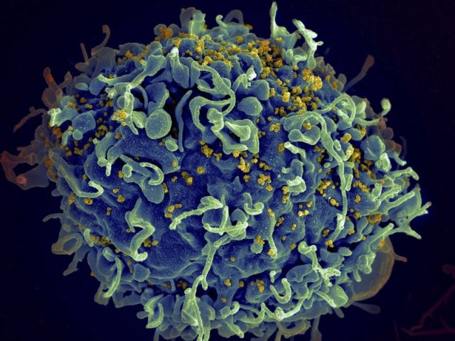 距治愈艾滋病又近一步 美科学家首次消灭老鼠病毒