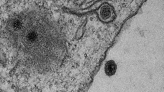 非洲再爆神秘病毒。病毒相继爆发，远古病毒逐渐被发现...人类从未战胜病毒...