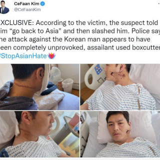怒了! 華裔男子當街遭鎚子砸頭 滿臉鮮血! 還有人遭割臉 "滾回亞洲"!