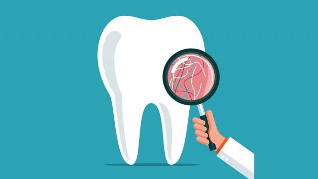 夏芳專欄 | 牙科保險購買預備知識