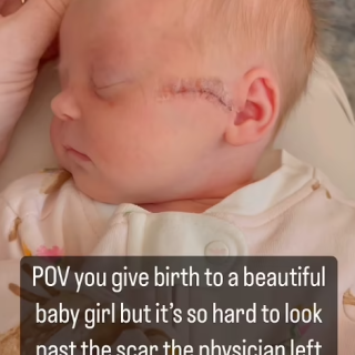 可怕！美國女子進行剖腹產 醫生「下刀太深」切開嬰兒臉​