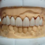 深圳市美牙牙义齿科技有限公司 深圳市美牙牙义齿科技有限公司